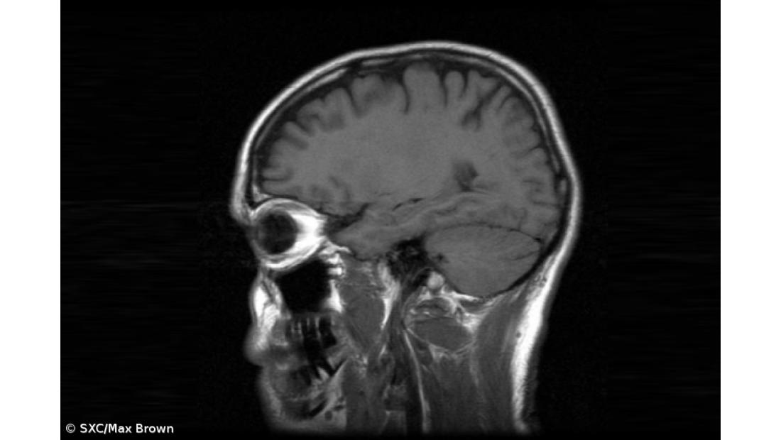 Teoria explica a relação entre complexidade cognitiva e assimetria cerebral