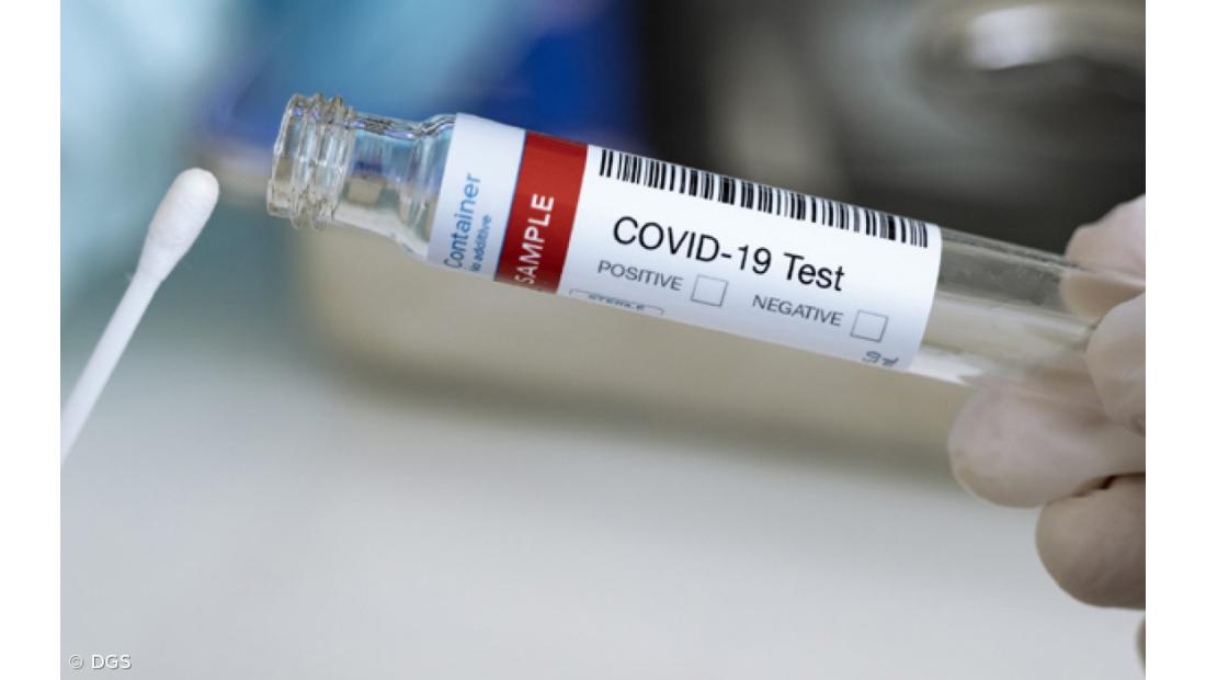 Açores com novo máximo diário de 1.123 novos casos positivos