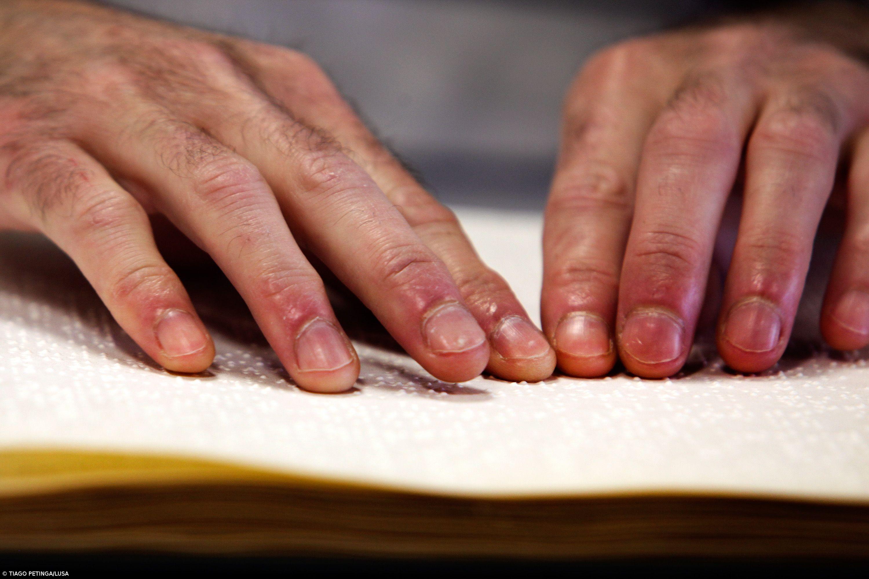 Um terço dos invisuais está desempregado e um em cada seis vive de prestação social – Imagem 1