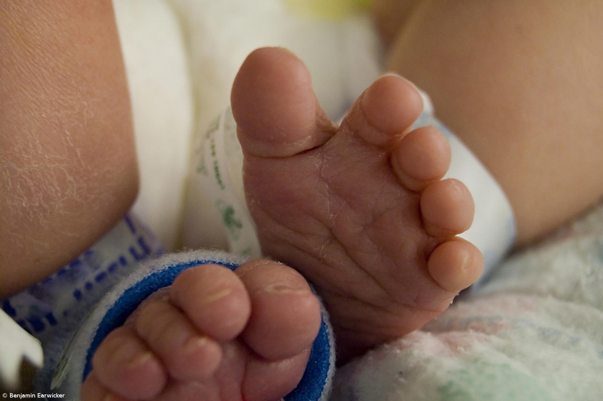 Nasceu primeiro bebé britânico com ADN de três pessoas – Imagem 1