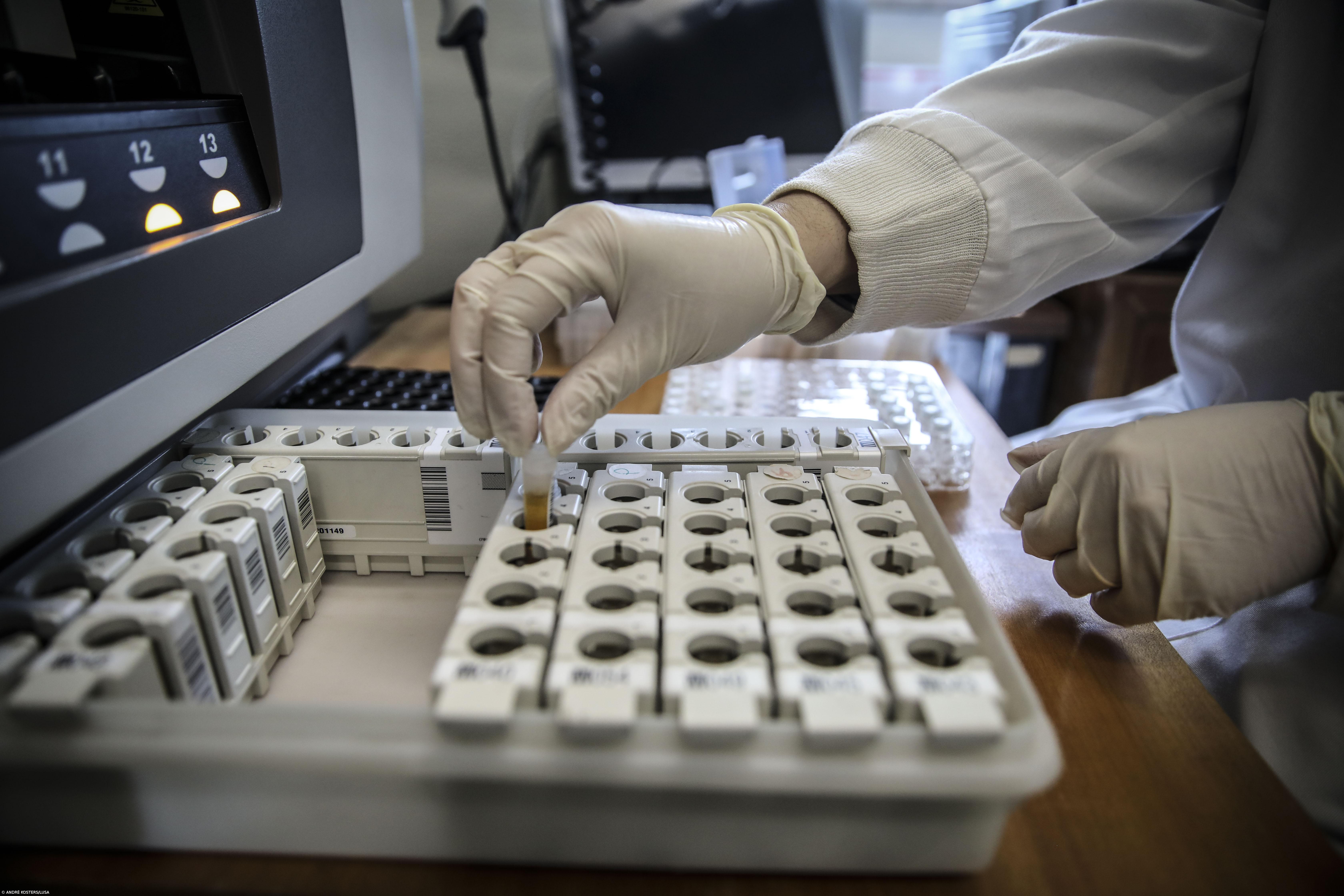 Açores detetaram 45 casos de infeção com a variante Ómicron – Imagem 1